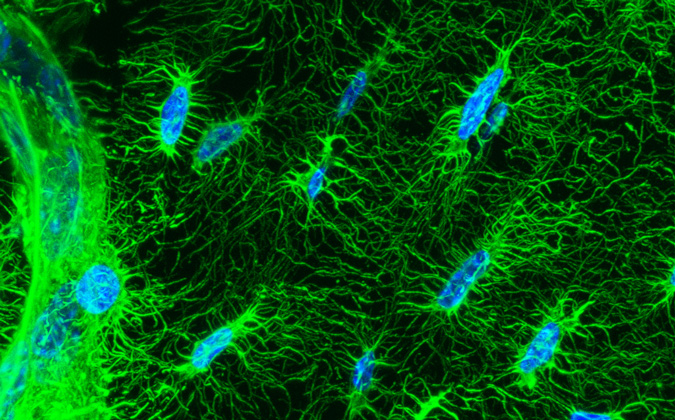 Confocal image of osteocyte cells found in the mineralized part of bone tissue. Osteocytes form a neural-like network that senses bone loading during exercise and adjusts bone mass to avoid fracture.