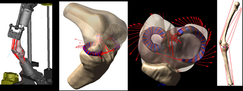 A computational knee model is validated by comparing motion to an identically-loaded cadaver knee.