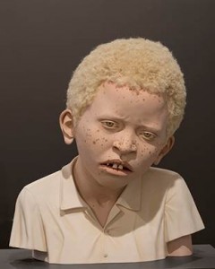 T.Toland-AfricanChildWithAlbinism
